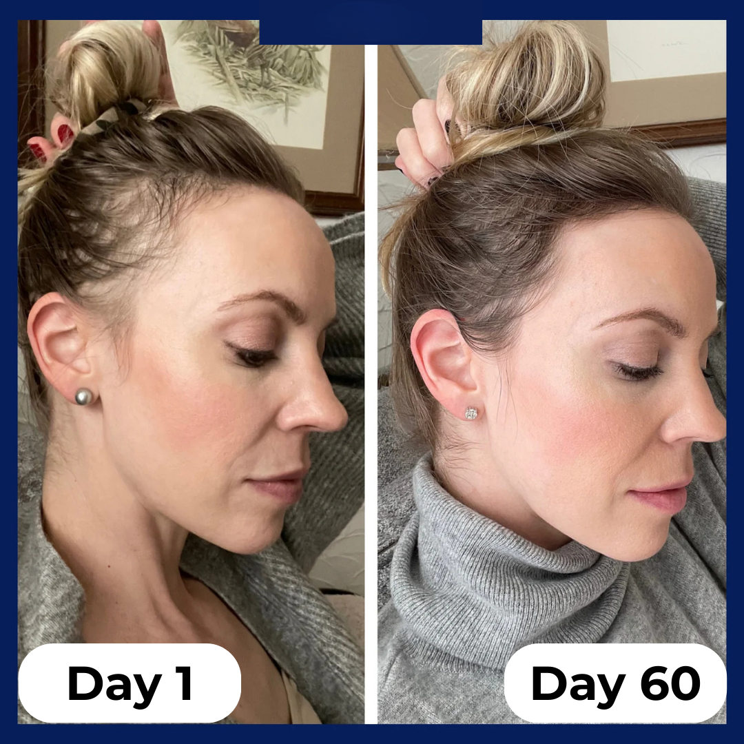 Hair Growth Serum Roll